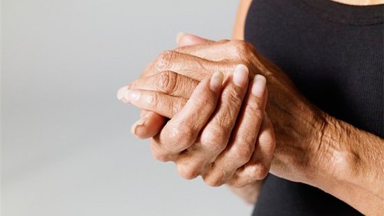 La artrosis sintomática de mano se asocia a mayor riesgo de infarto