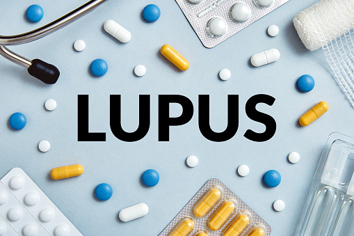 Webinar sobre tratamientos para pacientes con lupus
