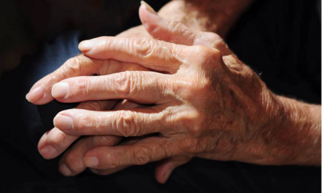 Artrosis: la enfermedad sin cura que merma las articulaciones de 500 millones de personas