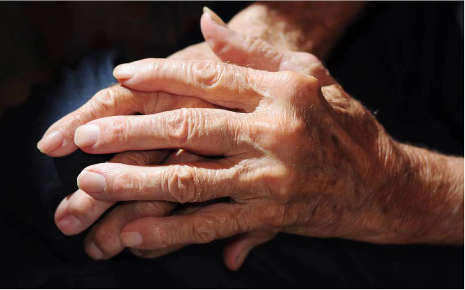 Artrosis: la enfermedad sin cura que merma las articulaciones de 500 millones de personas
