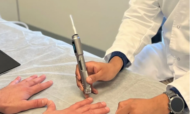 Enfermedad de Raynaud, así afecta al color de tus dedos