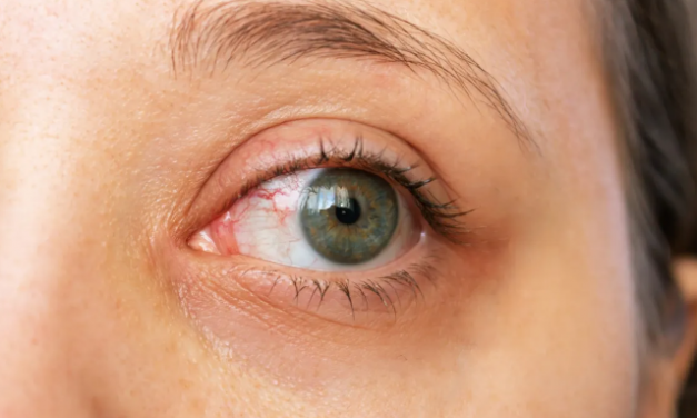 Claves sobre la uveítis, la tercera causa de ceguera en España