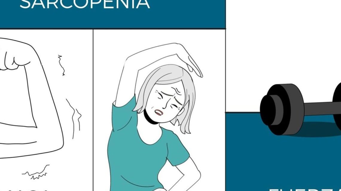 Recomendaciones de la Sociedad Española de Reumatología para tratar la sarcopenia: dieta y ejercicio