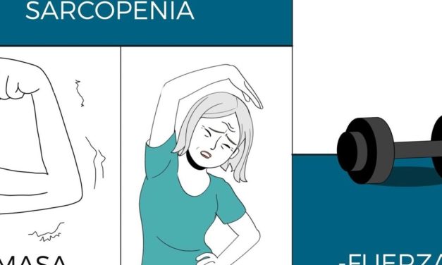 Recomendaciones de la Sociedad Española de Reumatología para tratar la sarcopenia: dieta y ejercicio