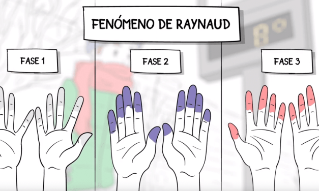 Fenómeno de Raynaud