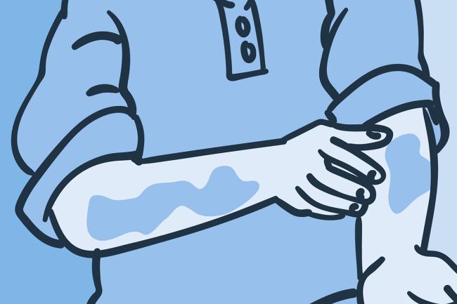 Descubriendo el síndrome VEXAS