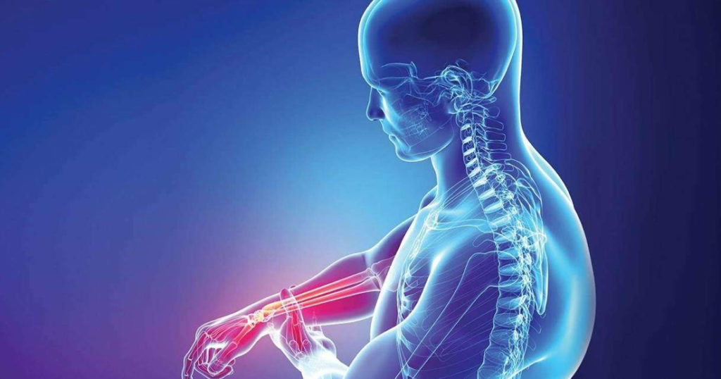 Miopatías inflamatorias