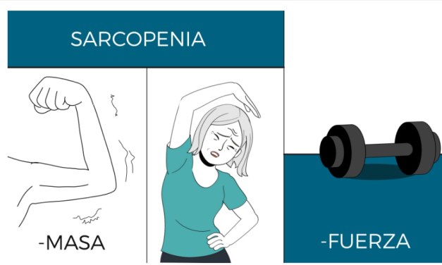 Mayores con pérdida de fuerza y masa muscular: si es sarcopenia se debe tratar