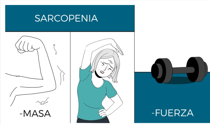 Mayores con pérdida de fuerza y masa muscular: si es sarcopenia se debe tratar