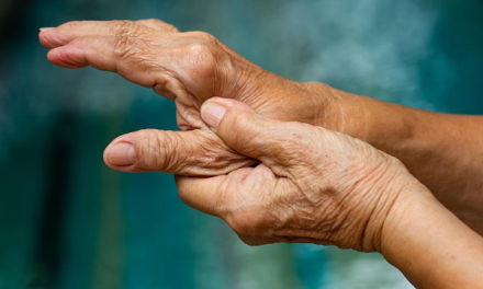 Descubren señales tempranas de artritis reumatoide antes de que aparezcan los síntomas