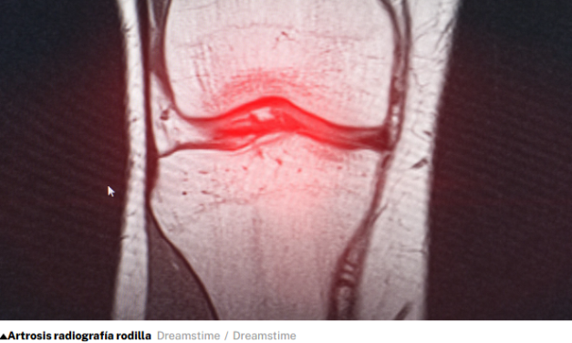 Un estudio revela que el ejercicio en casa es tan eficaz como la fisioterapia para aliviar el dolor de rodilla