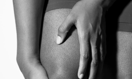 ¿Artritis de rodilla? El ejercicio puede ayudar a controlar el dolor