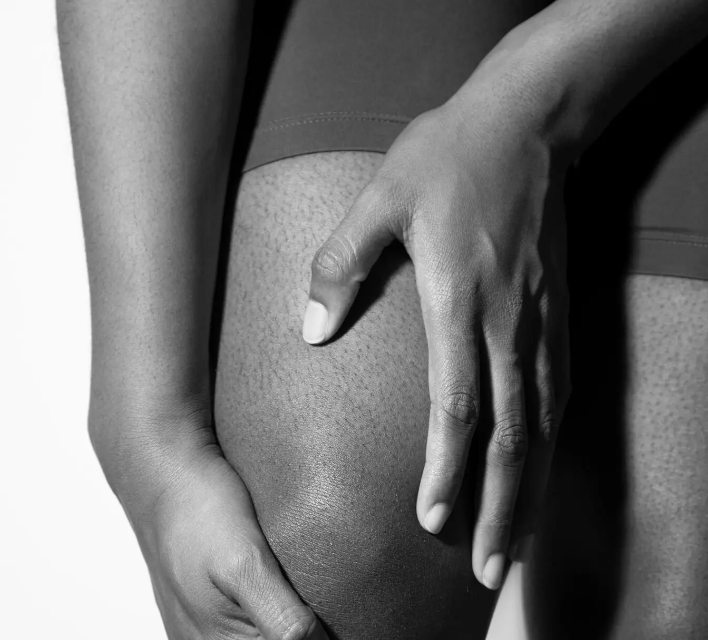 ¿Artritis de rodilla? El ejercicio puede ayudar a controlar el dolor