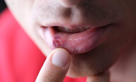 Asociación Española de la Enfermedad de Behçet (AEEB)