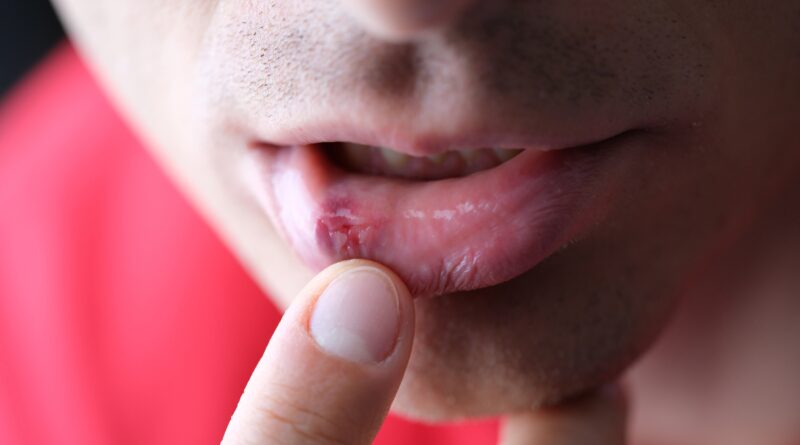 Asociación Española de la Enfermedad de Behçet (AEEB)