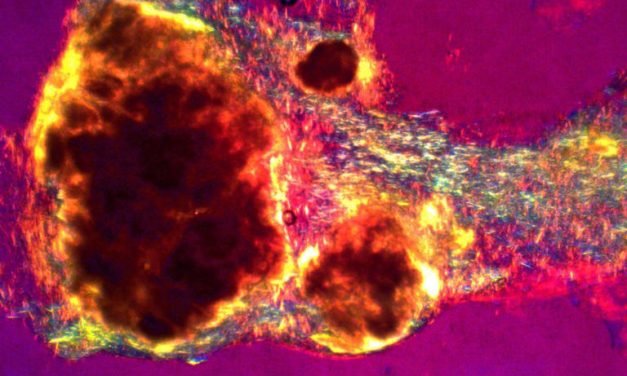 ¿Amenaza de gota? Estos son los alimentos que puedes comer, y los que no, en estas Navidades