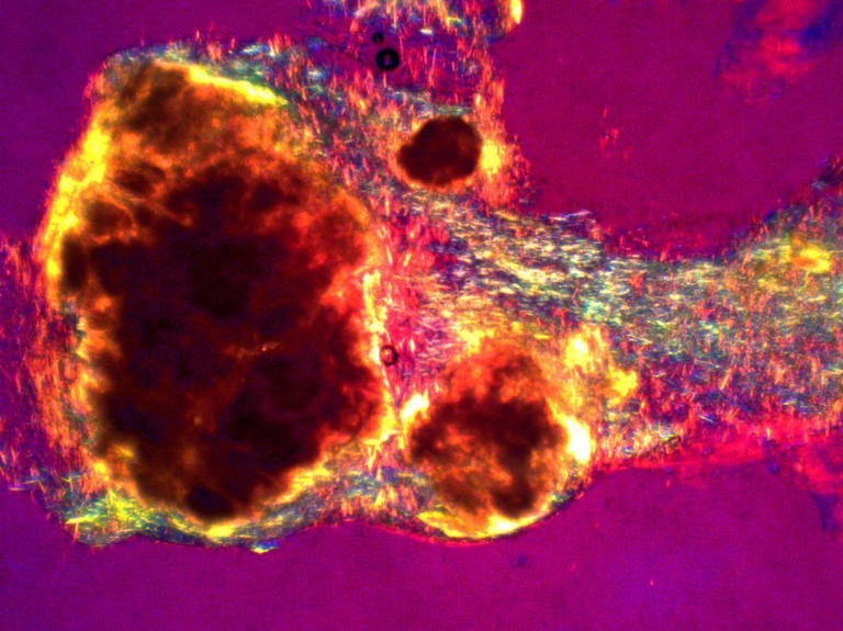 ¿Amenaza de gota? Estos son los alimentos que puedes comer, y los que no, en estas Navidades