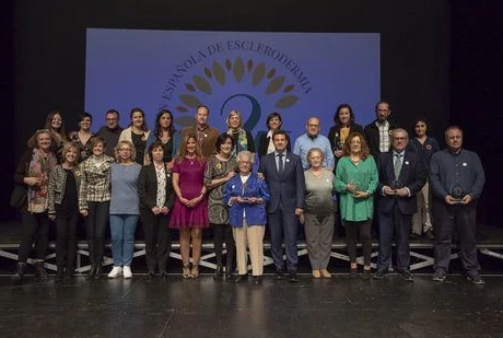 Asociación Española de Esclerodermia prepara publicación de guía “100 Preguntas sobre Esclerosis Sistémica”