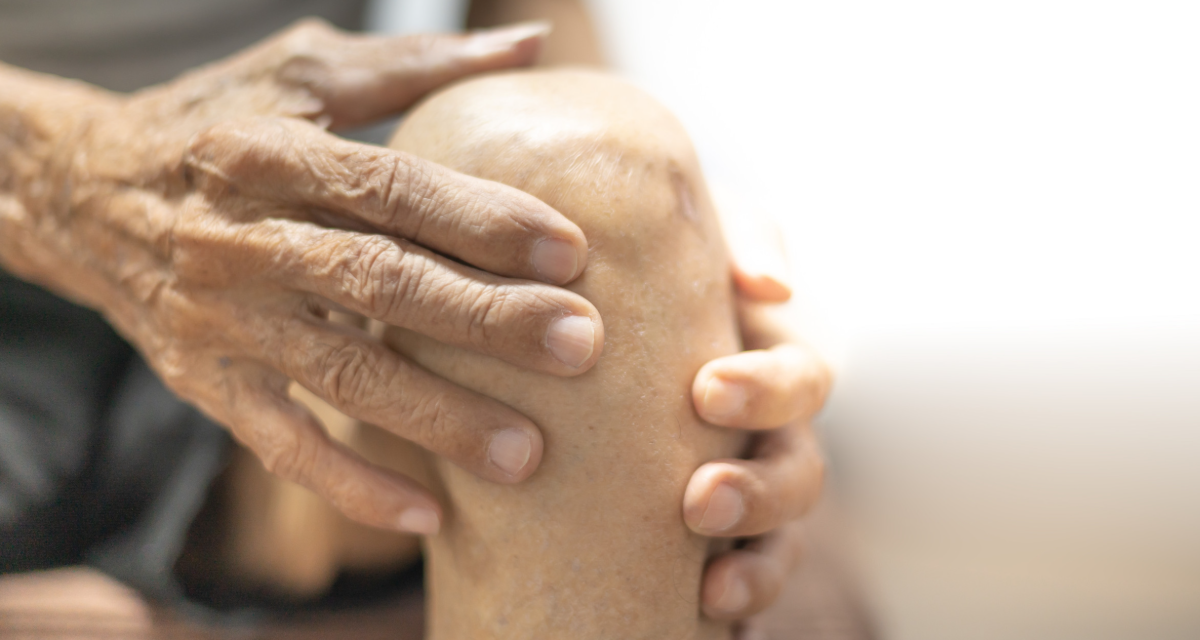 Nanopartículas detienen la progresión de la artrosis en un modelo animal