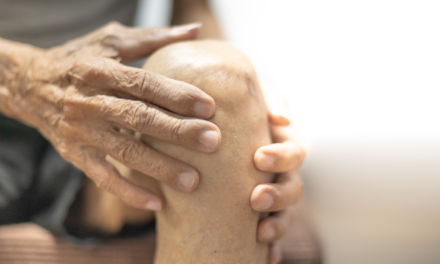 Nanopartículas detienen la progresión de la artrosis en un modelo animal