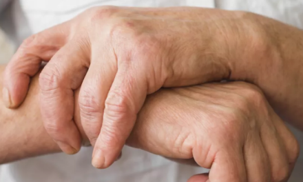 Cuatro consejos médicos que alivian el dolor de la artritis y la artrosis