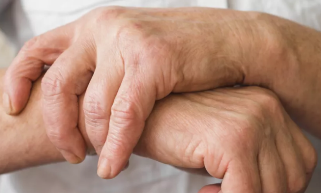 Cuatro consejos médicos que alivian el dolor de la artritis y la artrosis