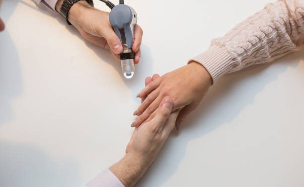 Una nueva guía clínica estandariza la atención enfermera a pacientes con esclerodermia, que afecta a más de 13.000 españoles